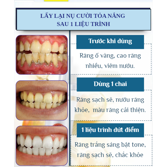 Kem Đánh Răng Jingxu Chunfu - Kem Jingxu Chunfu Giúp Trắng Sáng Răng, Cải Thiện Sâu Răng, Hôi Miệng, Hơi Thở Thơm Mát