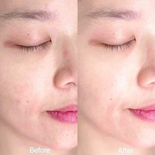 Serum Vitamin C Esthemax 561