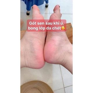 Ủ CHÂN BONG DA CHẾT Nhật Bản