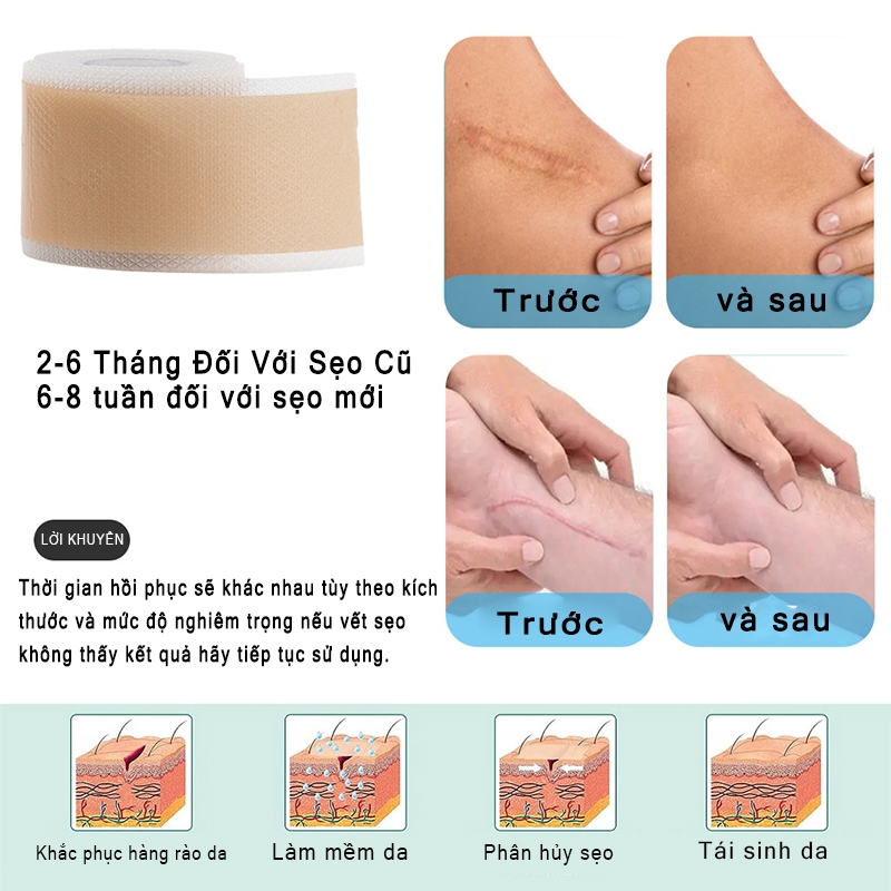 Miếng Dán Liền Sẹo Flushy Scar Tape - Miếng Dán Flushy Thảo Dược Hỗ Trợ Làm Mờ Da Sẹo, Phục Hồi Da