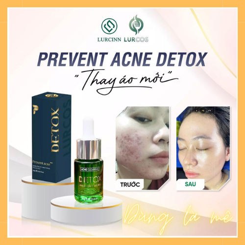 Chăm Sóc Da Mặt_Giảm mụn mờ thâm LURCINN Prevent Acne Detox. Serum phục hồi da tổn thương do mụn cho cả Nam và Nữ