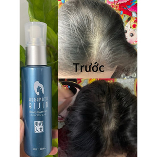 Xịt mọc tóc Nhật Bản