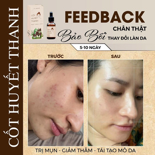 Chấm Mụn Thảo Dược Cốt Huyết Thanh