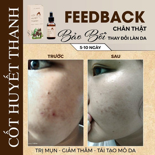 Chấm Mụn Thảo Dược Cốt Huyết Thanh