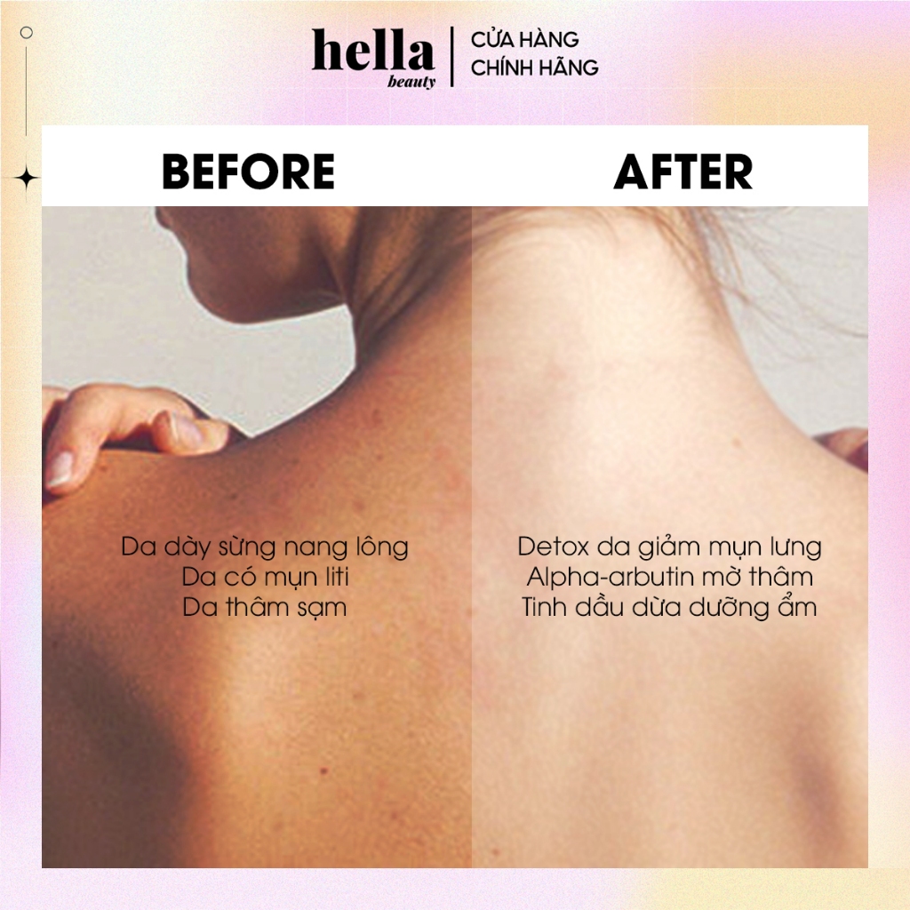 Tẩy Tế Bào Chết Body Cà Phê Hữu Cơ 500g Hella Beauty Giúp Dưỡng Sáng Da Toàn Thân, Giảm Mụn Mờ Thâm | BigBuy360 - bigbuy360.vn