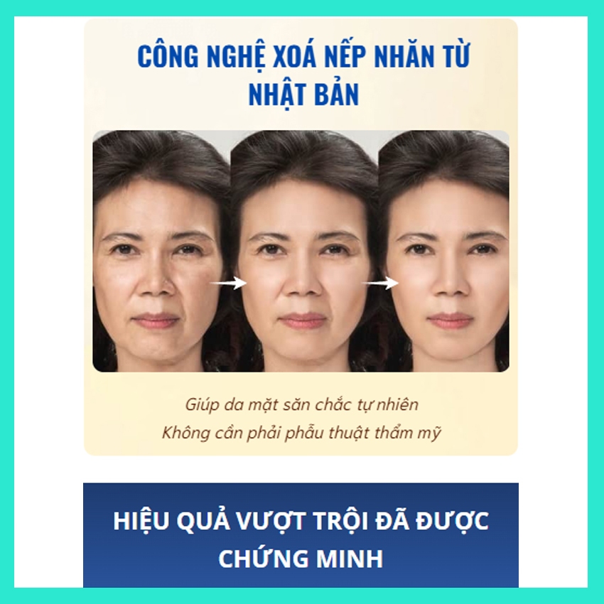 Kem chống lão hóa QINGLIN xóa thâm nám, mờ nếp nhăn và se khít lỗ chân lông Kem chống lão hoá - LECARO