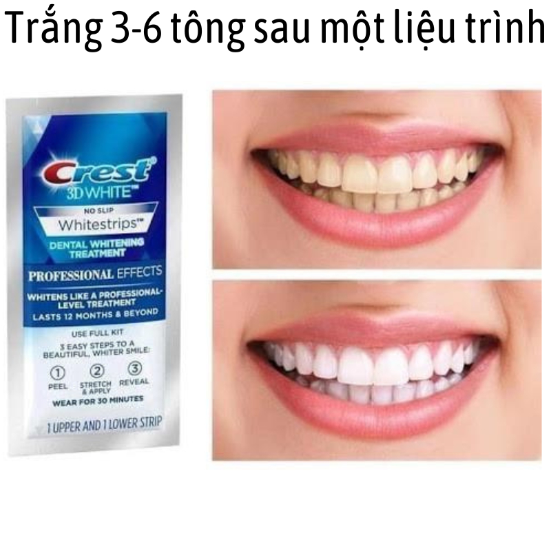 Miếng dán trắng răng Crest trắng nhanh không gây ê buốt phù hợp với mọi