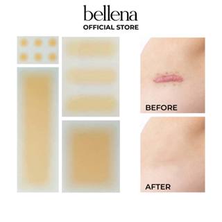 Miếng dán che sẹo khuyết điểm mụn sẹo lồi nốt ruồi Bellena S1