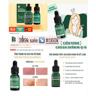 Tinh chất caryophy giảm mụn, mờ thâm mụn Caryophy Portulaca Ampoule