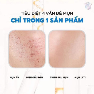 Kem Chấm Mụn Actidem