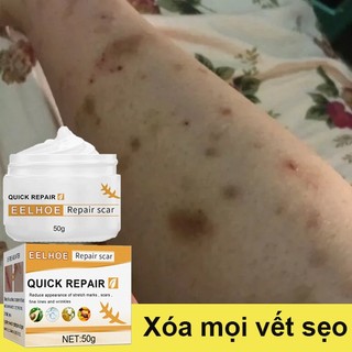 Kem xóa sẹo Kem mờ sẹo mờ thâm sẹo mờ sẹo kem bôi mờ sẹo thâm loại bỏ hiệu quả các vết sẹo cũ sẹo Vết sẹo do muỗi đốt