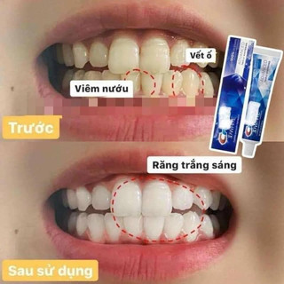 Kem Đánh Răng Crest Trắng 3D White