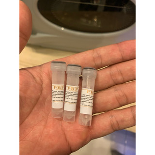 bộ kit  prp ACD A gel chân không