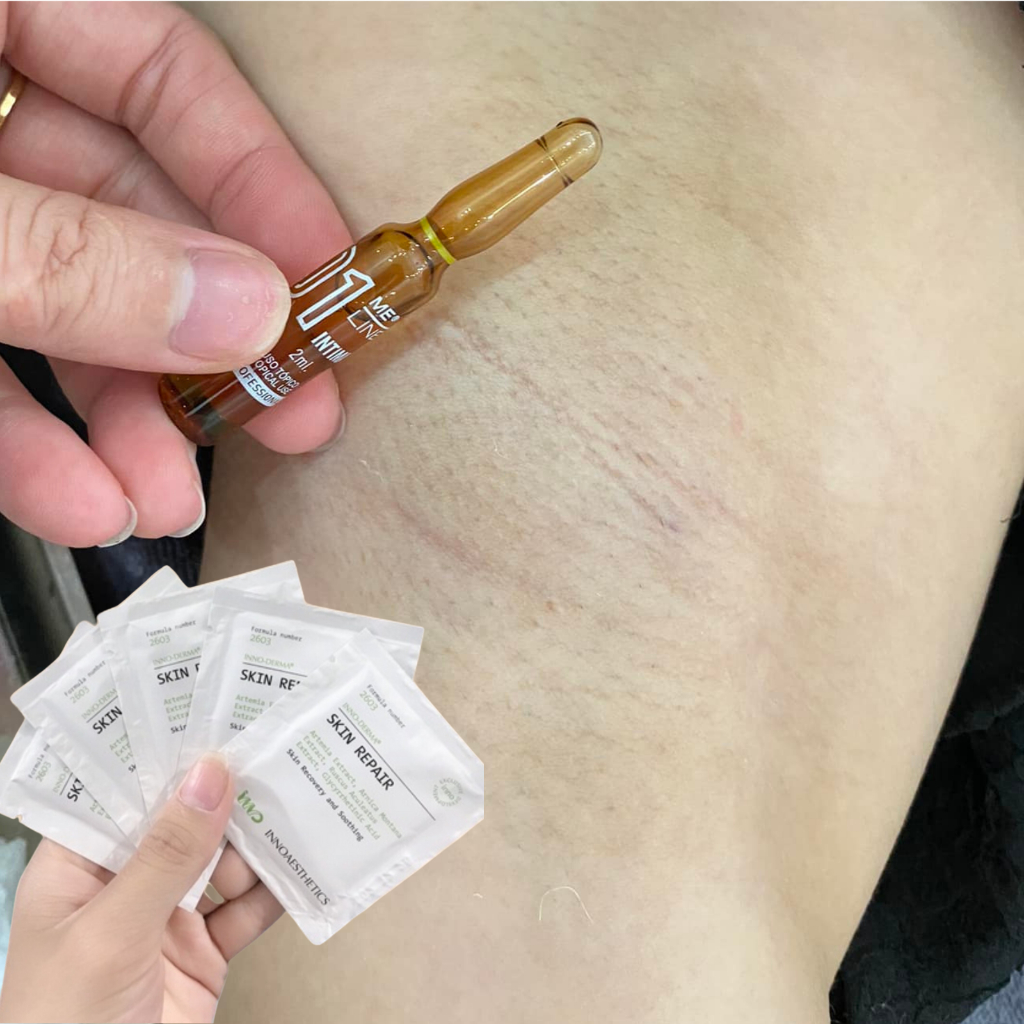 Tặng kem dưỡng Bộ Peel hỗ trợ giảm thâm vùng kín nách bẹn 2ml Intimate