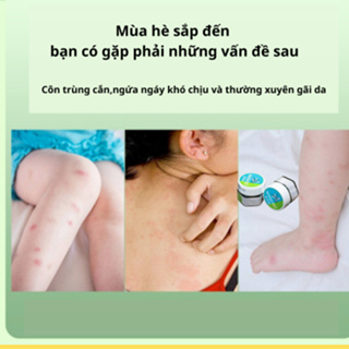 Kem Bôi Muỗi Đốt Thái Lan, Cao Chống Muỗi Baby Mosquito Balm Hỗ Trợ Giảm