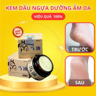 Kem dầu ngựa nứt gót chân, chai sần