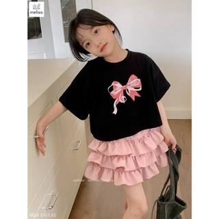 Bộ MLS nơ ngực