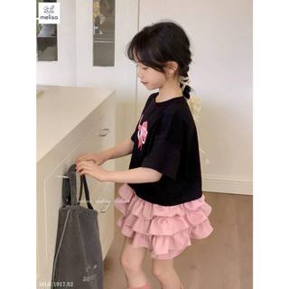 Bộ MLS nơ ngực