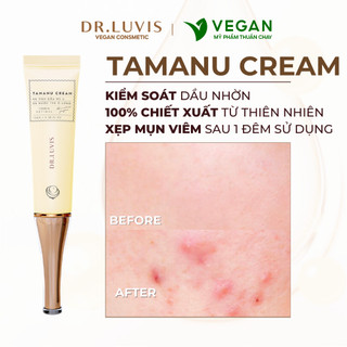 Kem giảm mụn Tamanu cream - giảm sưng, viêm hiệu quả sau 24 giờ