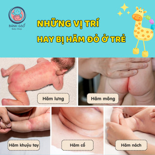 ( Hàng 2 tem - chính hãng ) Kem chống hăm tã em bé Sudocrem