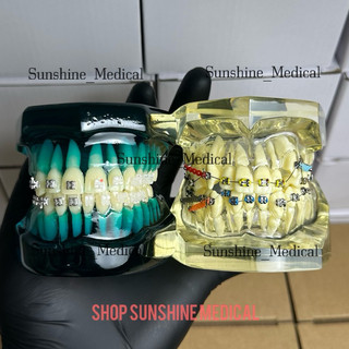 Mẫu hàm tư vấn, chỉnh nha , gắn mắc cài kim loại - mắc cài sứ - khí cụ chuyên dùng hỗ trợ chỉnh nha