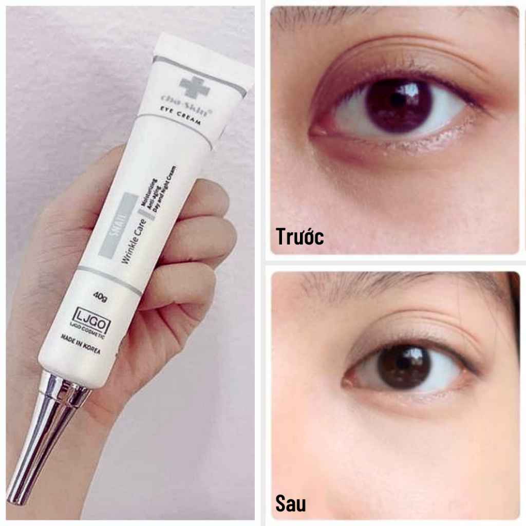Kem mắt LJGO Snail Wrinkle Care Cha Skin Eye Cream Giảm Thâm Ngăn Ngừa Lão Hóa Mắt 40ML| Moska Shop