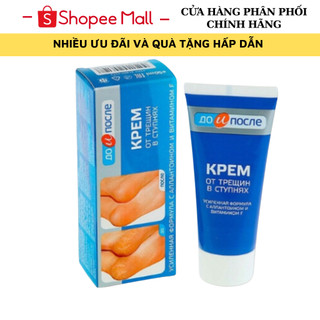 Kem Nứt Nẻ Gót Chân Kpem Nga 50ml Giúp Giảm Nẻ Chân,Tái Tạo Và Phục Hồi Da Gót Chân Hiệu Quả, TTC BEAUTY