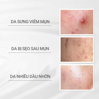 Nước cân bẳng dành cho da mụn d Program Acne Care Lotion 125ml