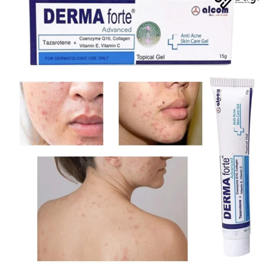 Gel giảm thâm mụn Gamma Derma Forte giảm viêm, mụn ẩn, mụn đầu đen 15g