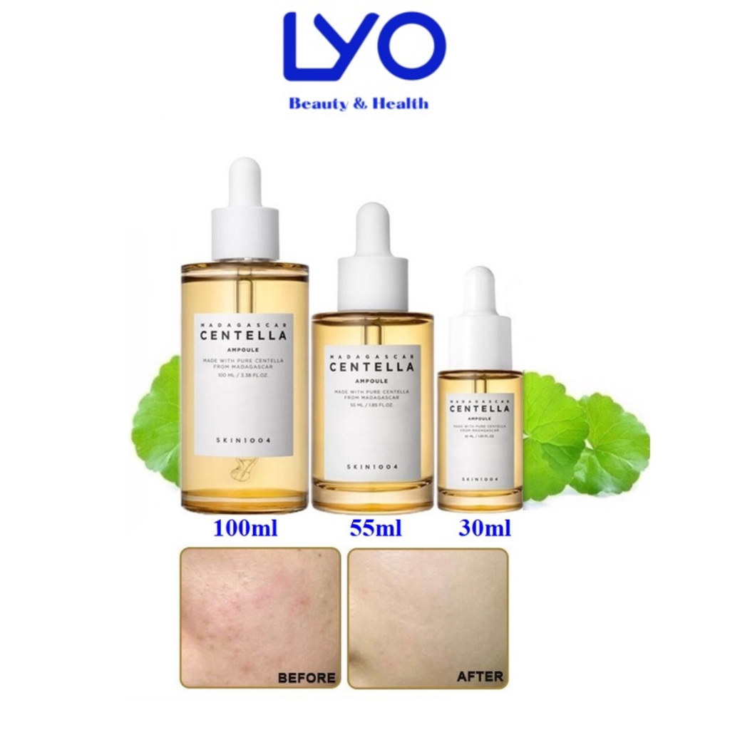 Tinh Chất Rau Má Giảm Mụn, Phục Hồi Da Centella Skin1004 Madagascar Serum 30 - 100ml