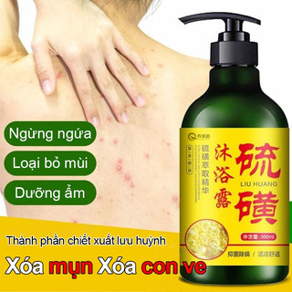 Sữa tắm lưu huỳnh Sữa tắm tẩy tế bào chết 500ml Loại bỏ mụn Giảm ngứa Kiểm soát dầu Loại bỏ mạt