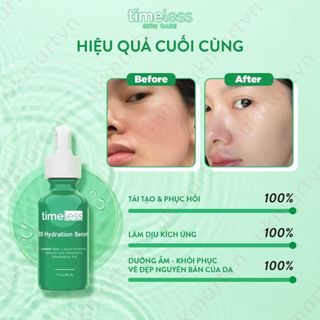 [Thanh lý] Serum Cấp Nước Phục Hồi Da Timeless Vitamin B5 30ml