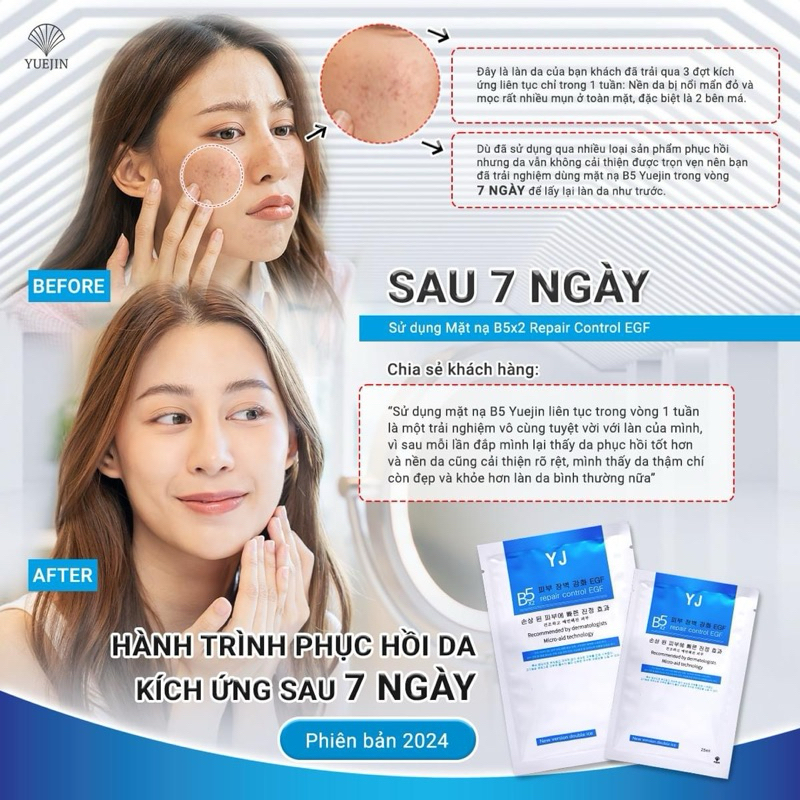 Mặt nạ Yuejin B5 Repair Control EGF Cấp ẩm phục hồi da (25ml) | BigBuy360 - bigbuy360.vn