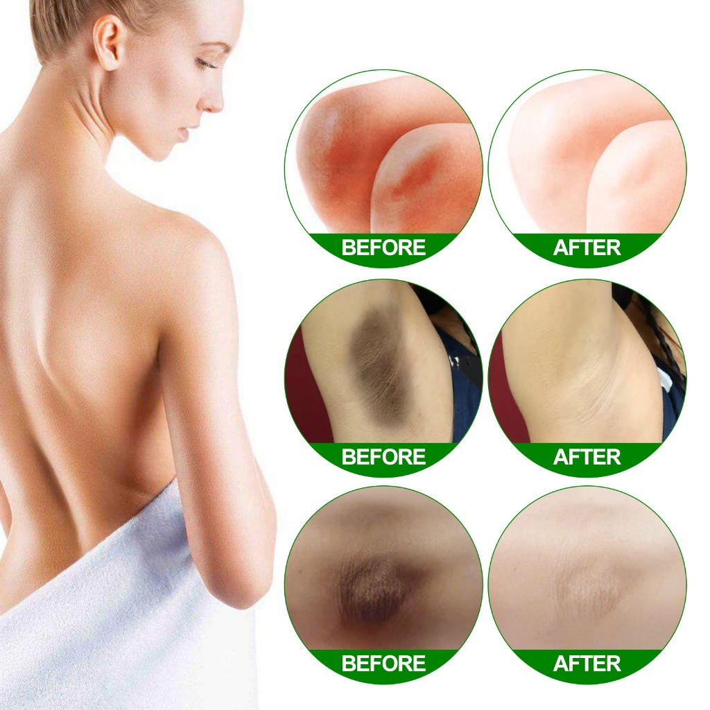 Chiết Xuất  Retinol EELHOE Xóa Thâm, Dưỡng Trắng, Cấp Ẩm, tái tạo tế bào chống lão hóa. [s]
