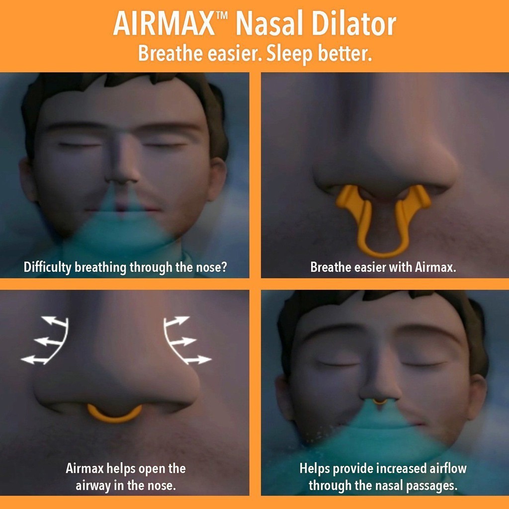 Vòng Chống Ngáy Ngủ Sleep Pease Nasal Dilator (Đeo Mũi Khi Ngủ)