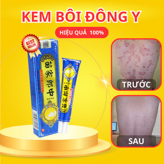 Kem bôi nấm ngứa hỗ trợ hắc lào, vẩy nến, á sừng, lang ben hiệu quả nhanh chóng - bà lão xanh hàng nội địa trung cao cấp