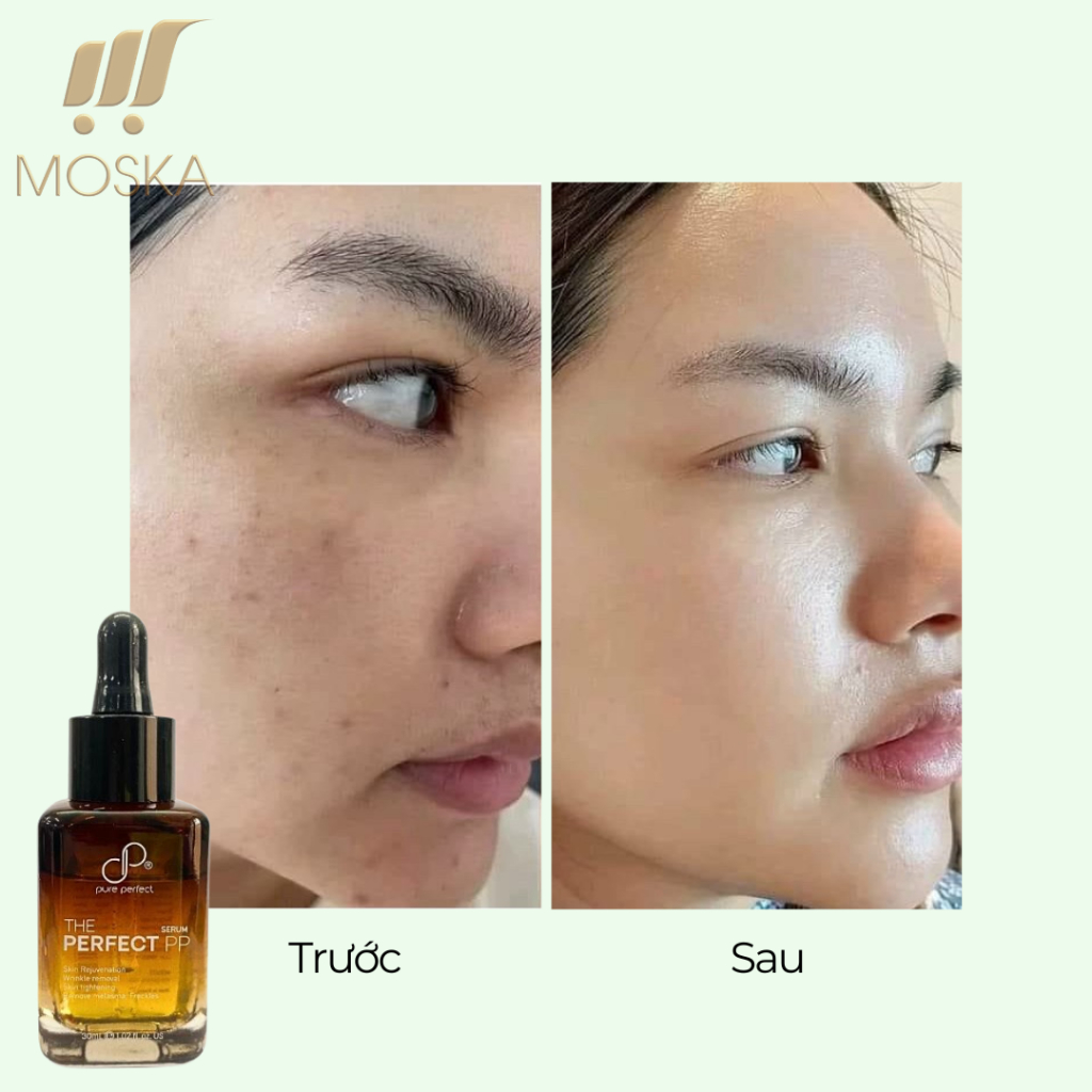 Serum Xóa Nếp Nhăn, Nám, Sạm The Perfect PP 30ml Đại Học Bách Khoa Hà Nội, Serum Dưỡng Da Trắng Hồng Rạng Rỡ Sau 14 Ngày
