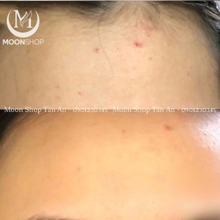 KEM DƯỠNG FIXDERMA SKAFIX-TX