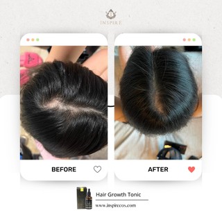 Serum INSPIRE Dưỡng Kích Thích Mọc Tóc