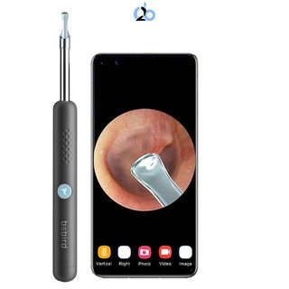 Bộ lấy ráy tai có camera Bebird R1. Lần cuối cùng bạn nhìn thấy trong lỗ tai mình là khi nào ?