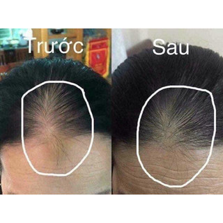 [Chính hãng] XỊT MỌC TÓC THÁI LAN HAIR TONIC GENIVE
