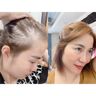 [Chính hãng] XỊT MỌC TÓC THÁI LAN HAIR TONIC GENIVE