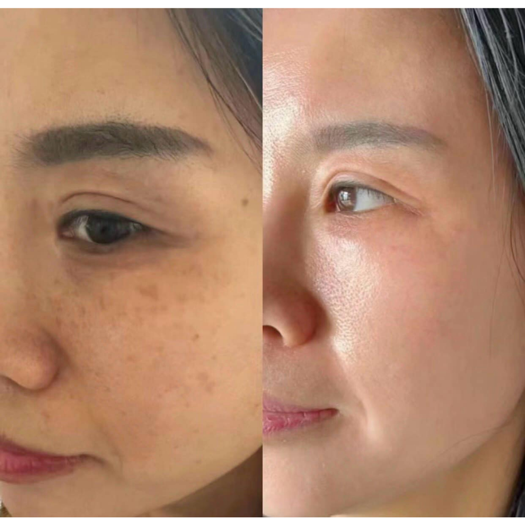 vn 11134207 7r98o lteoo6eb82ah9c