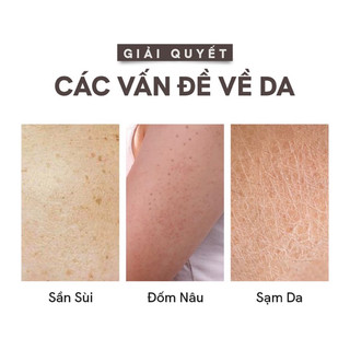 KEM DƯỠNG DA TOÀN THÂN SỮA DÊ