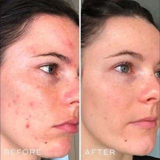 MEDIK8 - Serum Medik8 Hydr8 B5 Hydration 60ml