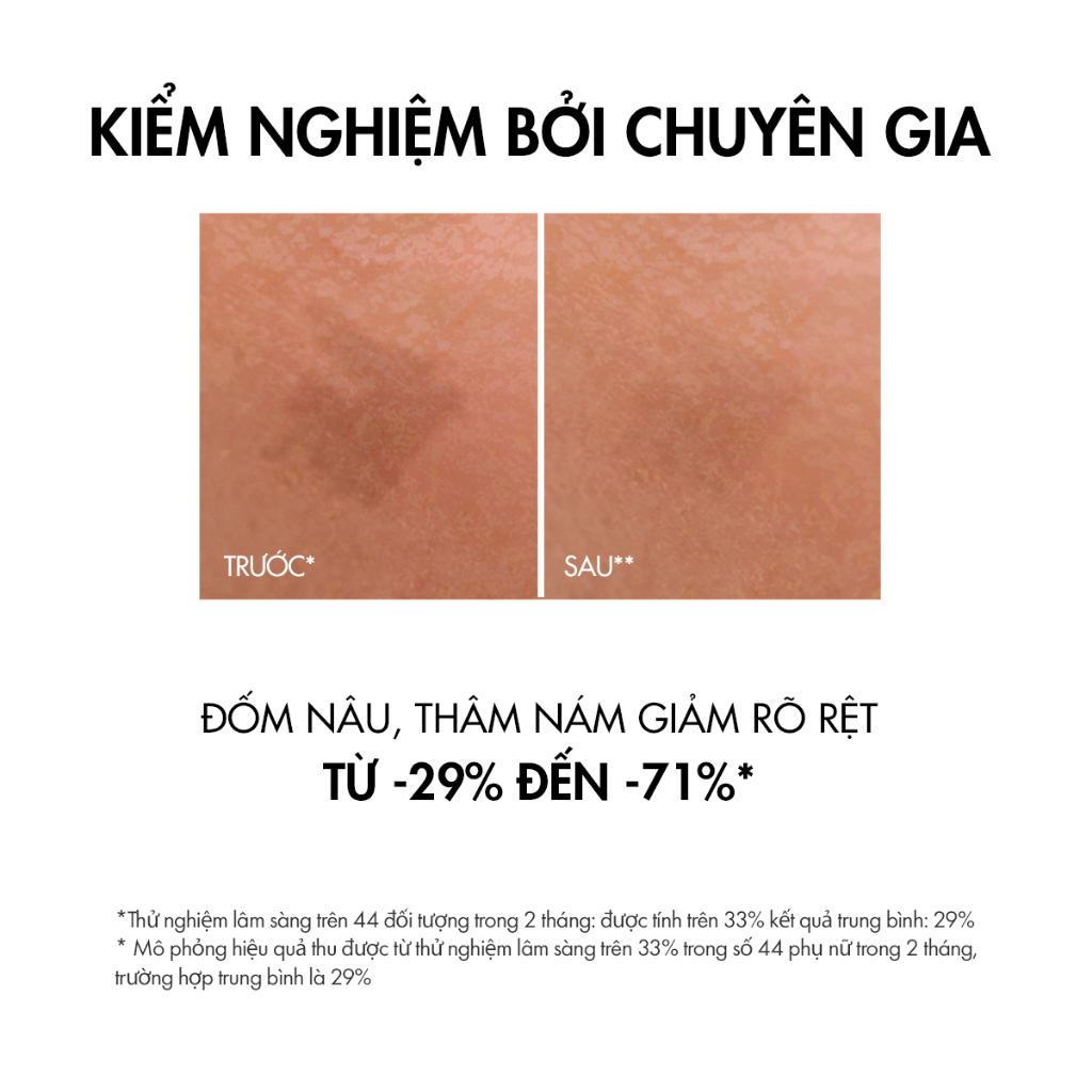 Tinh chất giúp cải thiện & ngăn ngừa thâm nám đốm nâu Vichy Liftactiv B3 dark spots 30ml