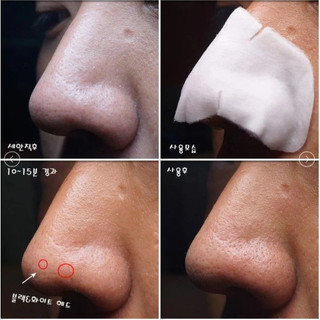 Miếng đẩy mụn Goodbye Blackhead
