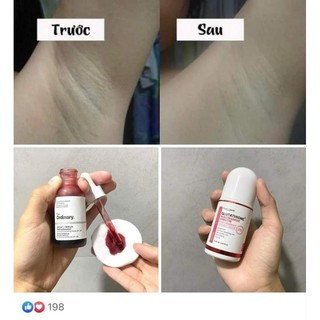 Lăn nách khử mùi chứa Glutathione làm trắng 50ml