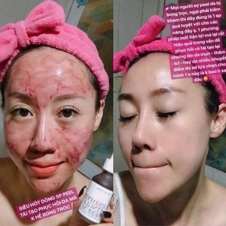 Tinh Chất Tái Tạo Da So Natural Red Peel Tingle Serum 35ml