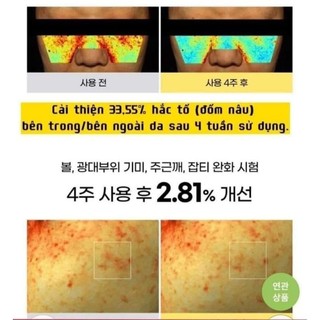 Tinh chất Goo.dal hỗ trợ làm sáng da, mờ đốm nâu Goo.dalVita C Dark Spot Care Serum
